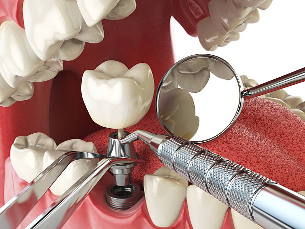 Best Knocked-Out Tooth Emergency  in Mentor On The Lake, OH